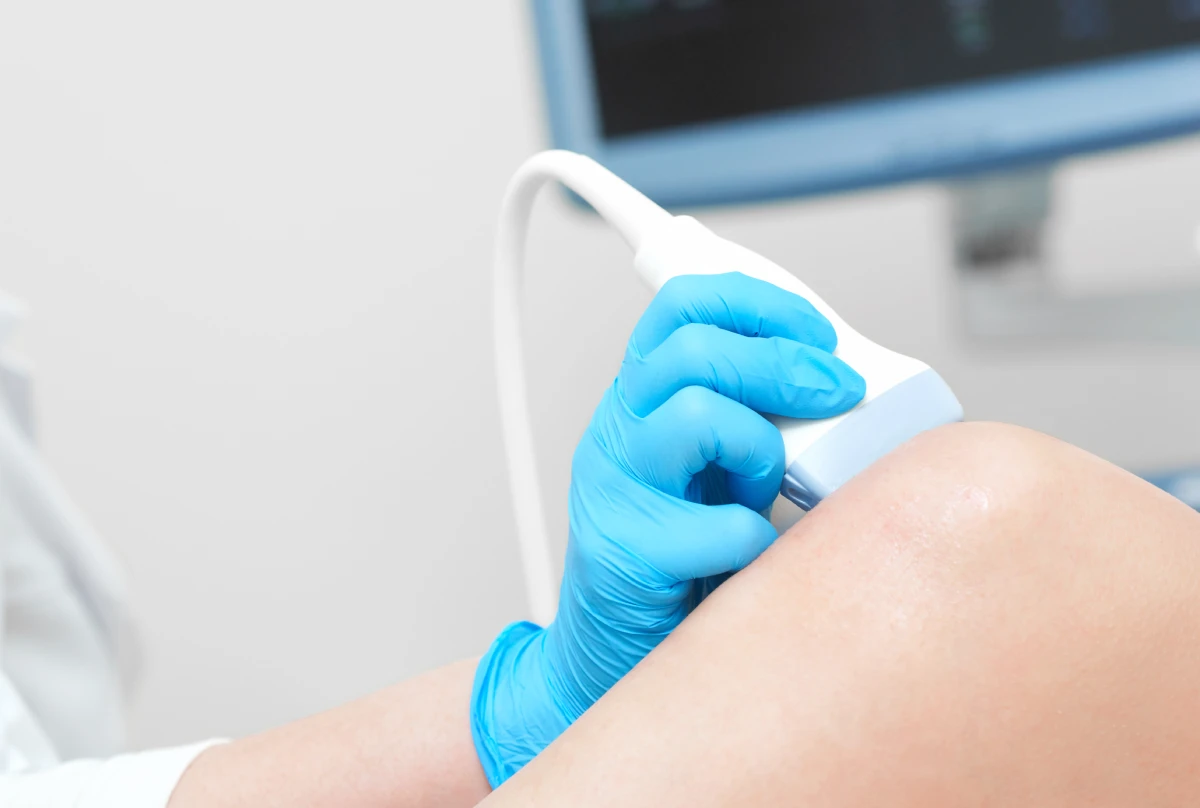 Construa Sua Confiança na Ecografia Vascular com Quem Entende de Verdade